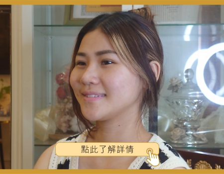 吳知錡小姐 縫式雙眼皮術後感想