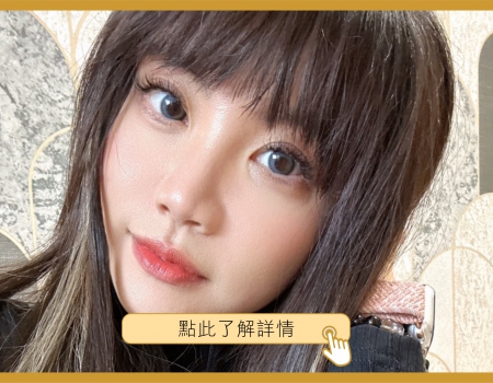 網紅Alice 波士頓醫美體驗